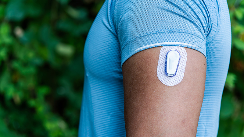 A continuous glucose monitor on a person's upper arm.