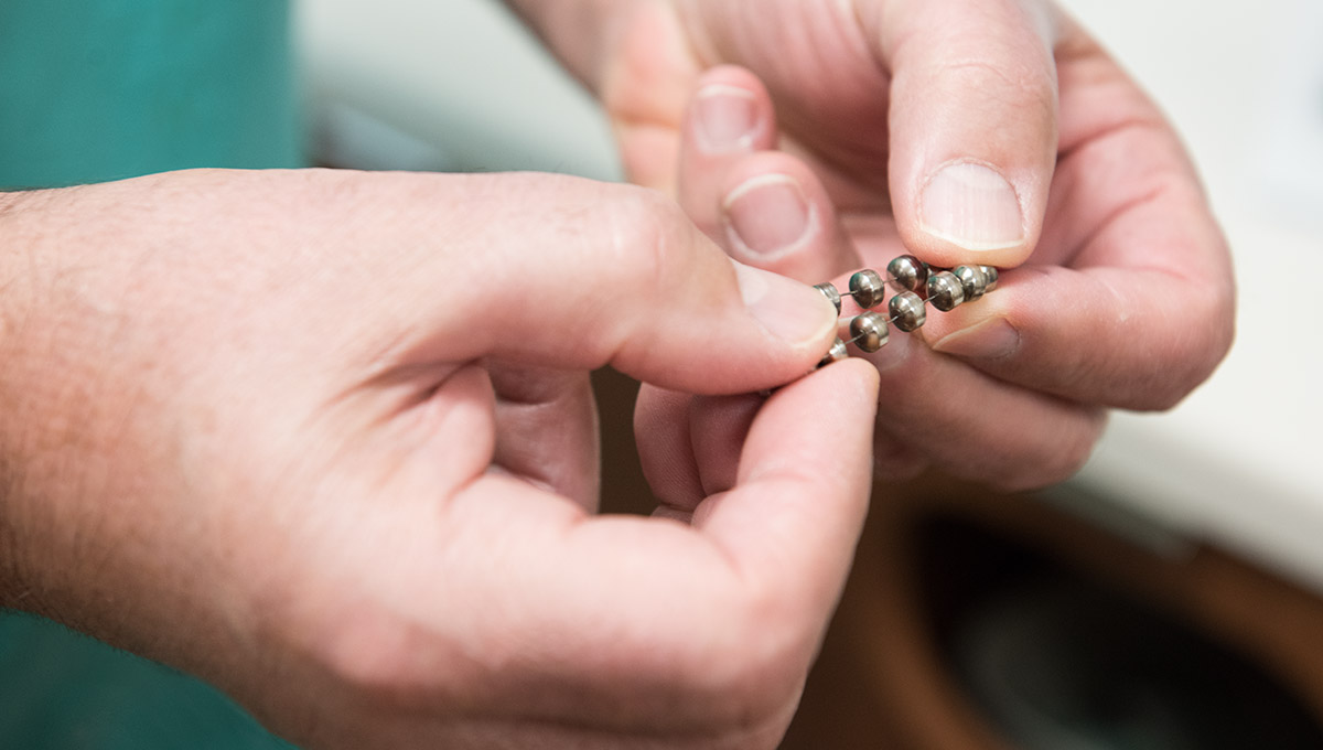 Linx Procedure For Treatment Of Gerd Northwestern Medicine linx procedure for treatment of gerd