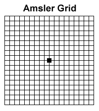 Grid Chart For Macular Degeneration