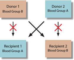 What are kidney donor requirements?