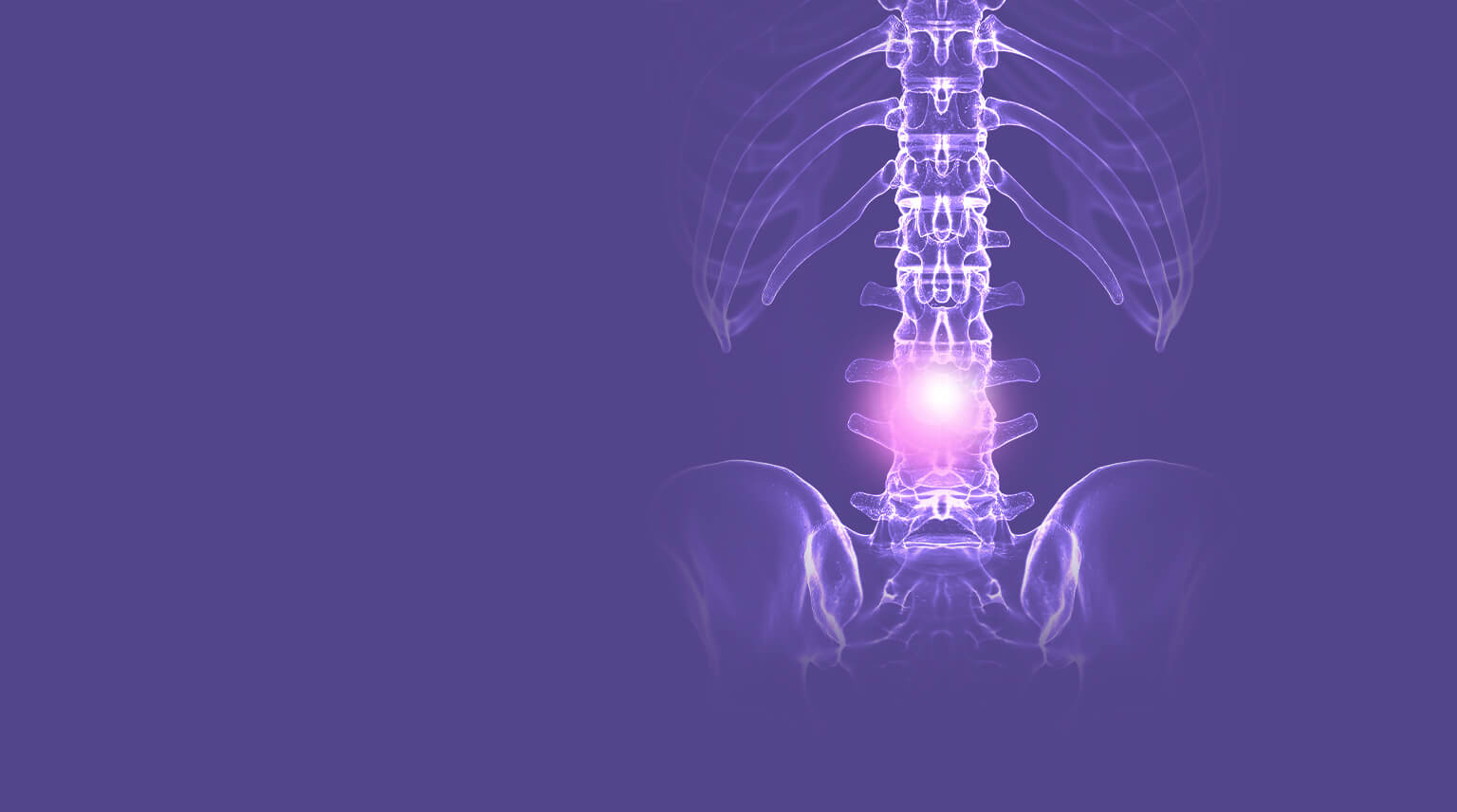 purple x-ray of a spine
