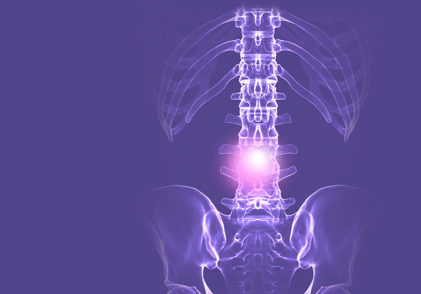 purple x-ray of a spine