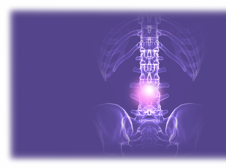 purple x-ray of a spine