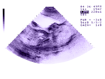 robin-ultrasound