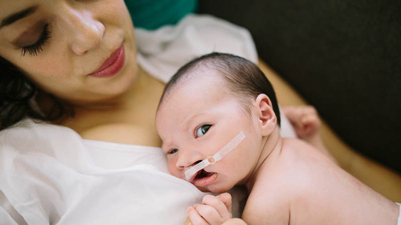 nm-craniofacial-awareness-month-tnail