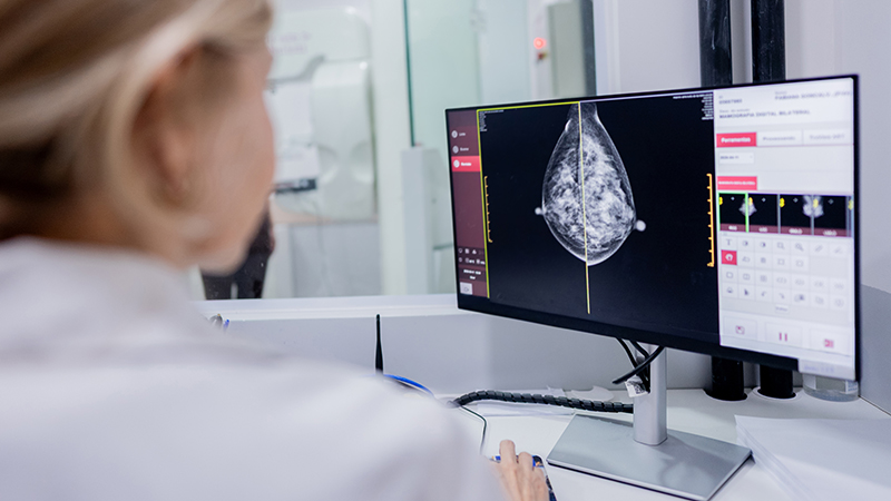 A doctor examining a mammography scan of dense breast tissue.
