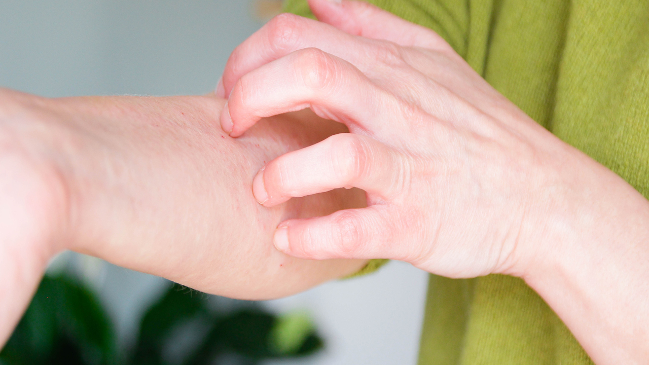 Person wearing a light green wool sweater itching the skin on their forearm.