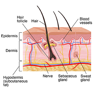 Cross section of skin showing epidermis, dermis and hypodermis.