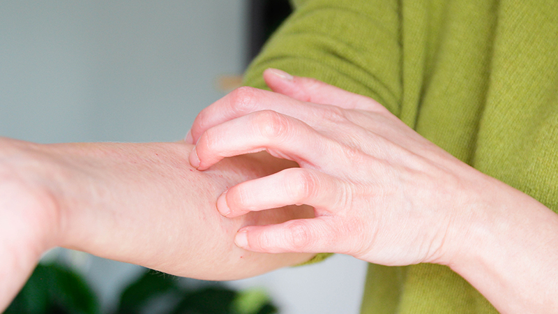 Person wearing a light green wool sweater itching the skin on their forearm.