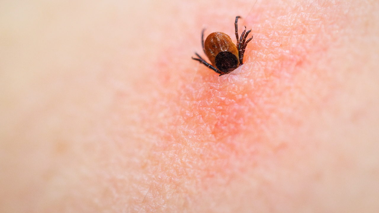 A brown wood tick entering human skin.