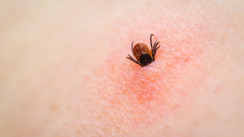 A brown wood tick entering human skin.