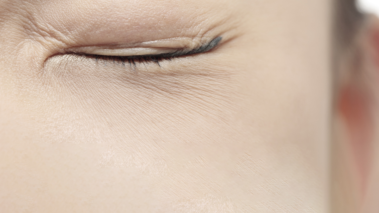 A person with brown hair closes one eye due to eyelid twitching.