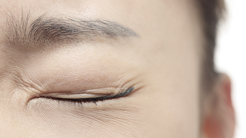 A person with brown hair closes one eye due to eyelid twitching.
