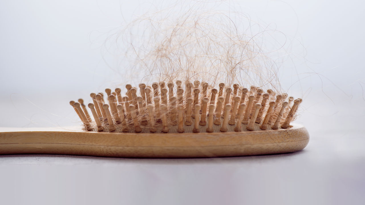 nm-hair-loss-what-you-need-to-know_feature