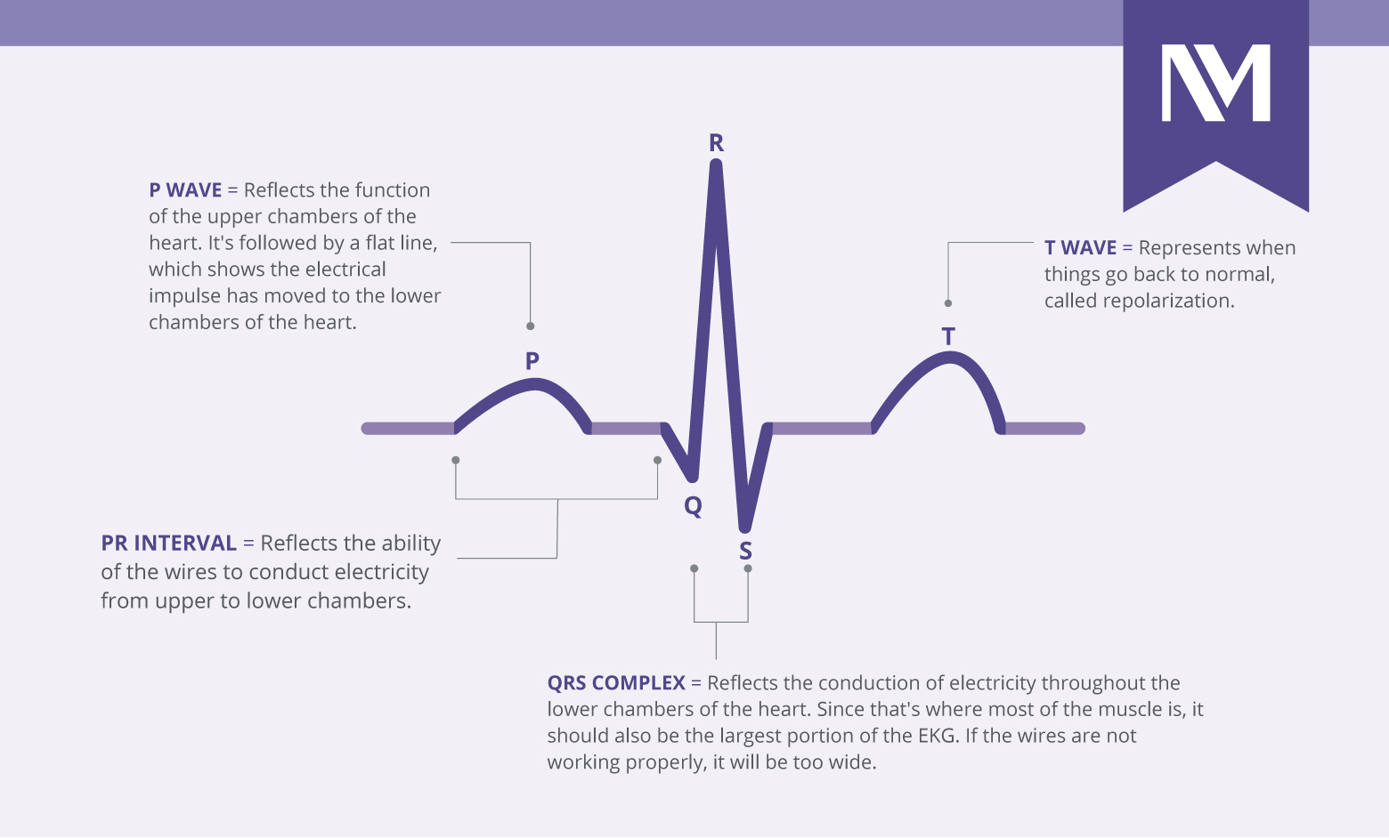 nm-how-to-read-EKG_line