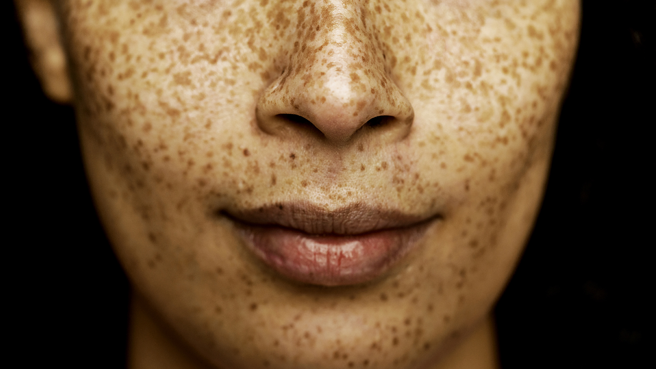 nm-is-post-nasal-drip-contagious_feature