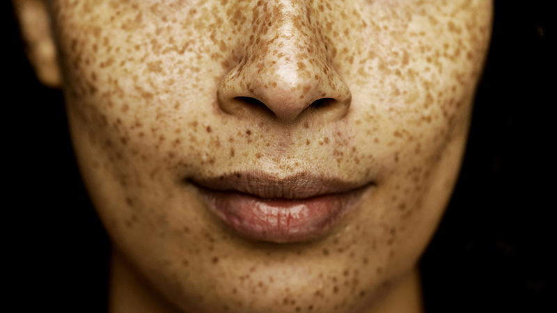 nm-is-post-nasal-drip-contagious_preview