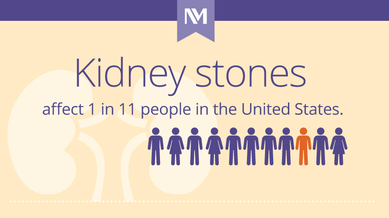 nm-kidney-stones-101_preview