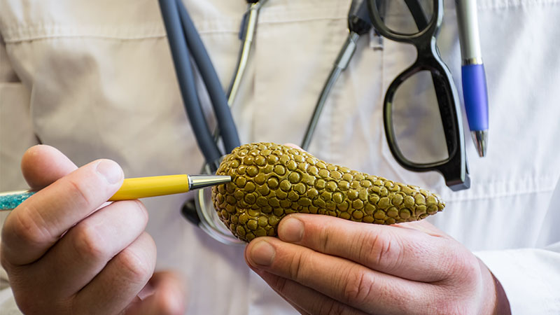 nm-pancreatic-cancer_preview