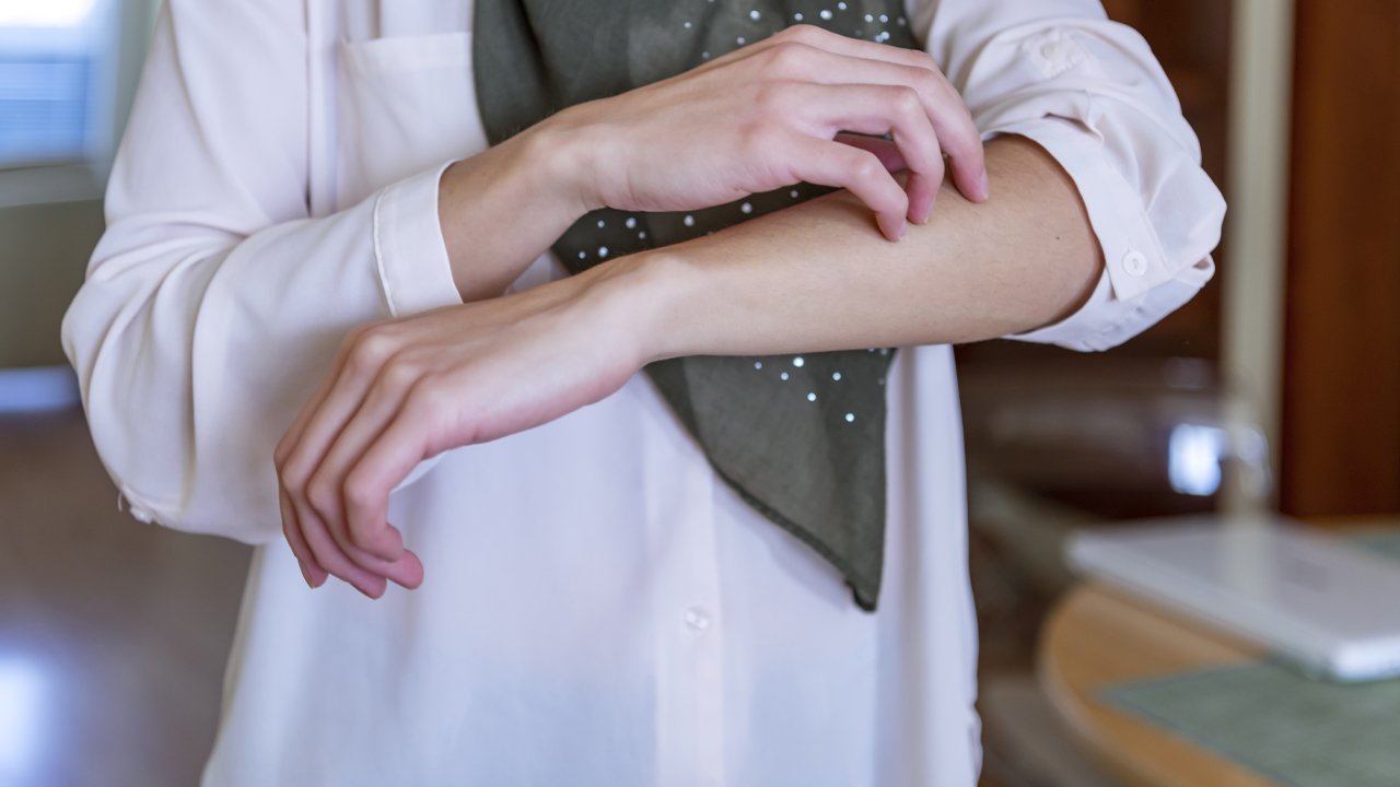 nm-psoriasis-vs-psoriatic-arthritis_feature