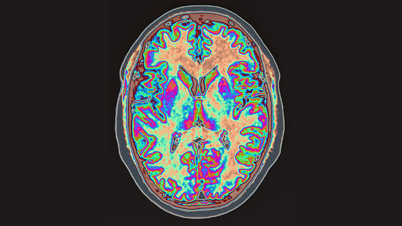 nm-when-immune-system-attacks-brain_preview