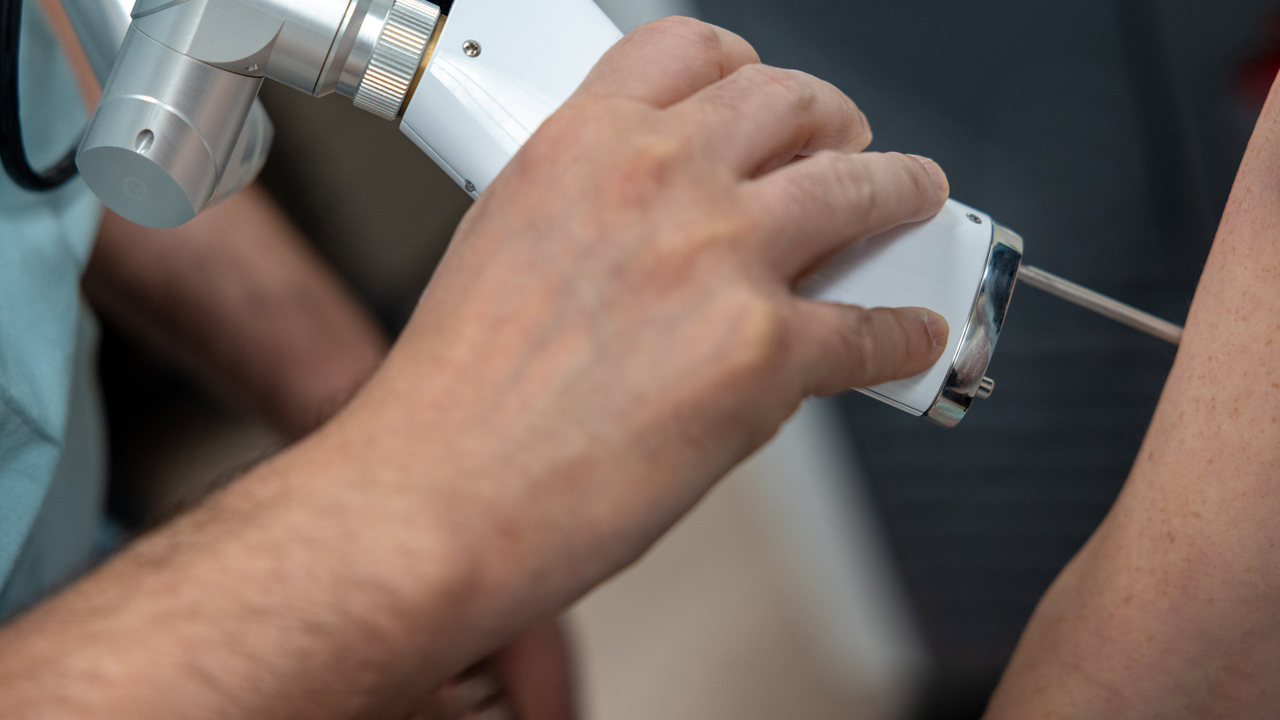 A close-up image of a physician using a machine to remove a tattoo from a patient.