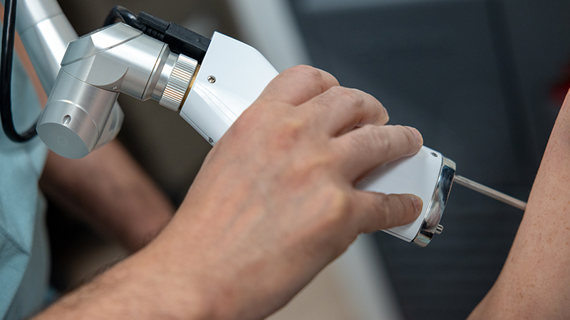 A close-up image of a physician using a machine to remove a tattoo from a patient.