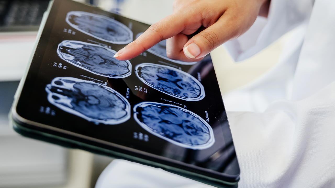 A doctor’s hand pointing at a brain scan.