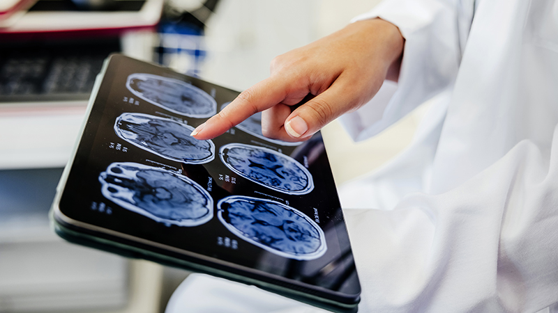 A doctor’s hand pointing at a brain scan.