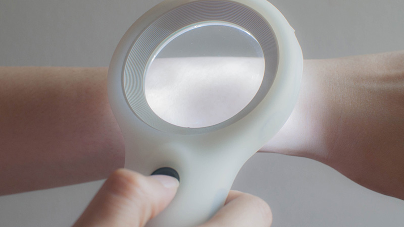 What-Are-Skin-Screenings_preview