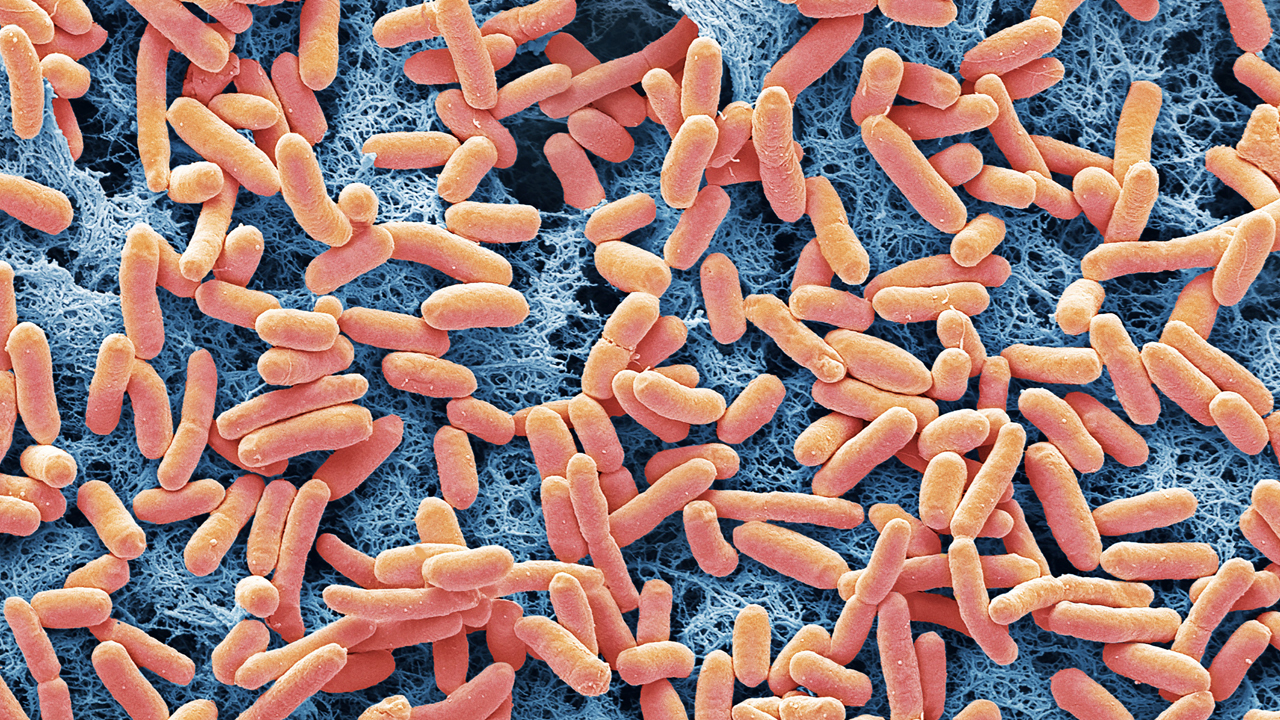 Magnified image of E. coli bacteria.