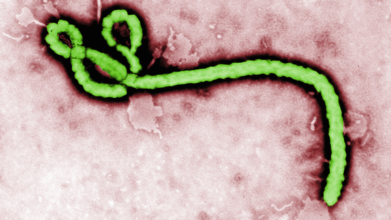 Close-up of an electron microscope image of the Ebola virus, showing long, thread-like particles.