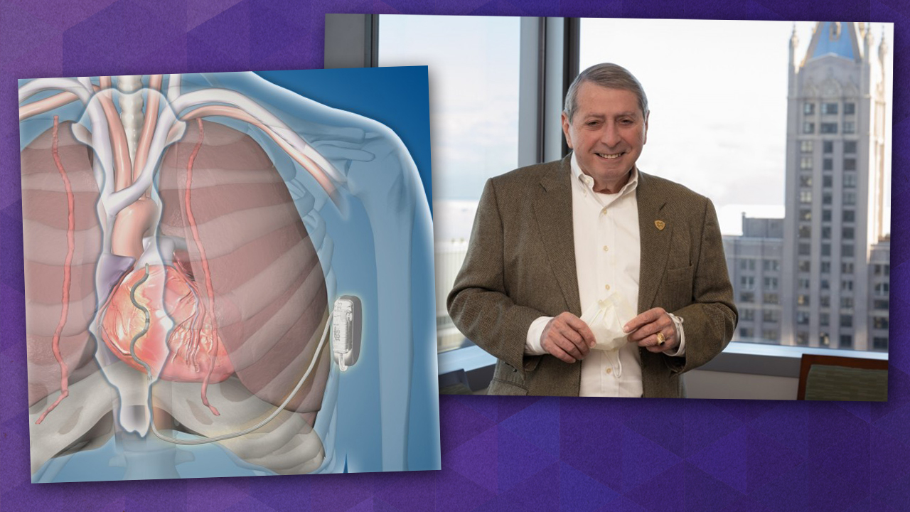 Two images overlayed onto a purple background. The left most image is of an illustration which shows the human heart and placement of the extravascular implantable cardioverter defibrillator on the right side of the chest. The other is of Joseph Mulligan, the clinical trial participant, smiling while standing in front of a window at Northwestern Memorial Hospital.