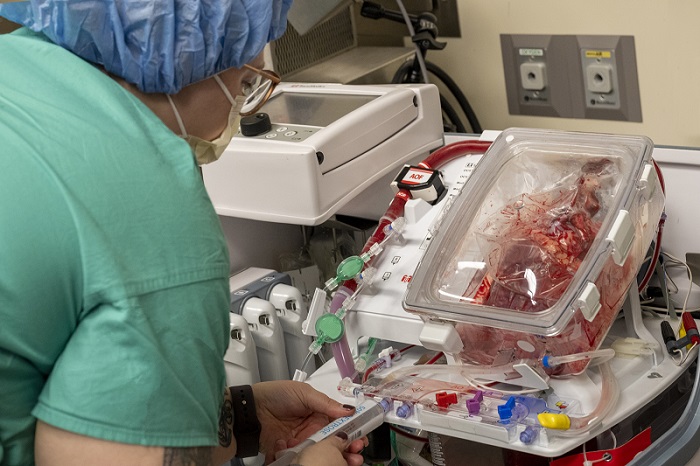 A clinician in green scrubs and a blue surgical cap monitors a live beating heart in a see-through box.