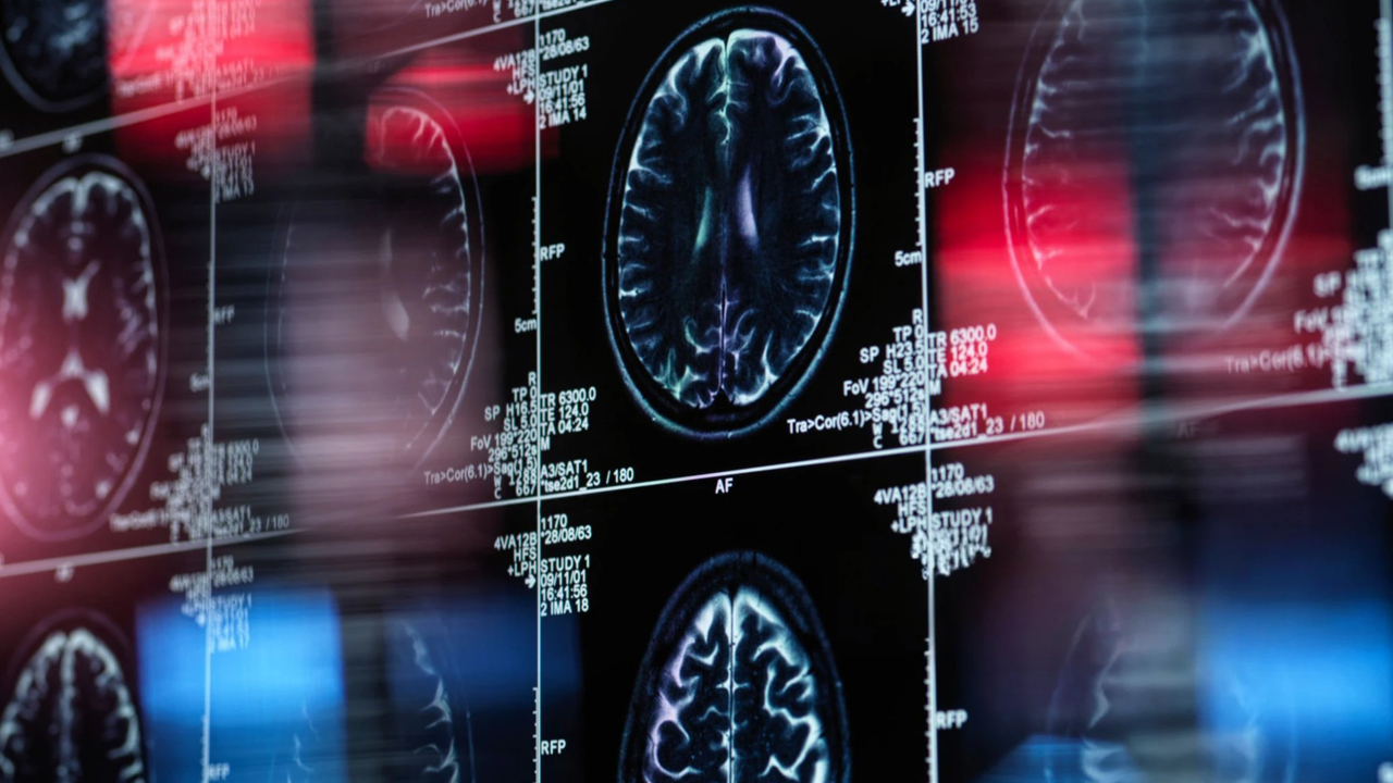 radiology image slides