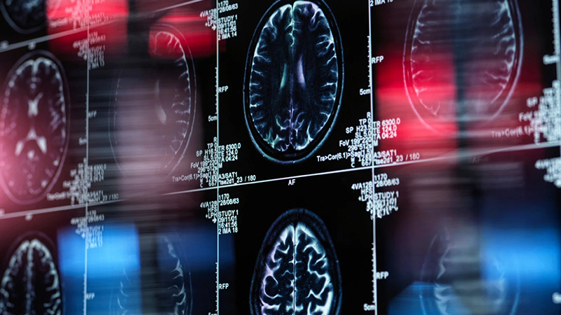 radiology image slides