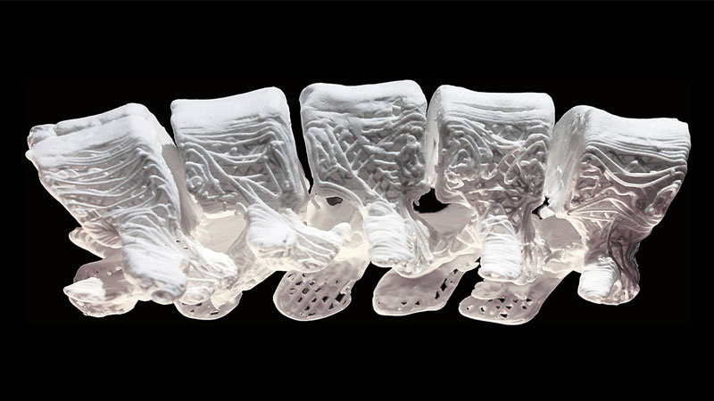 nm-building-better-bones-with-3d-printing-thumb
