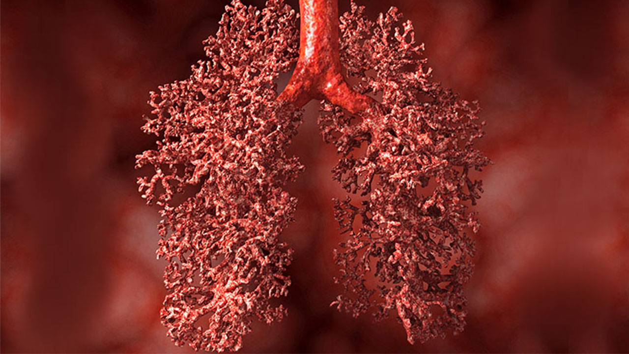 nm-detect-lung-cancer-early_feature