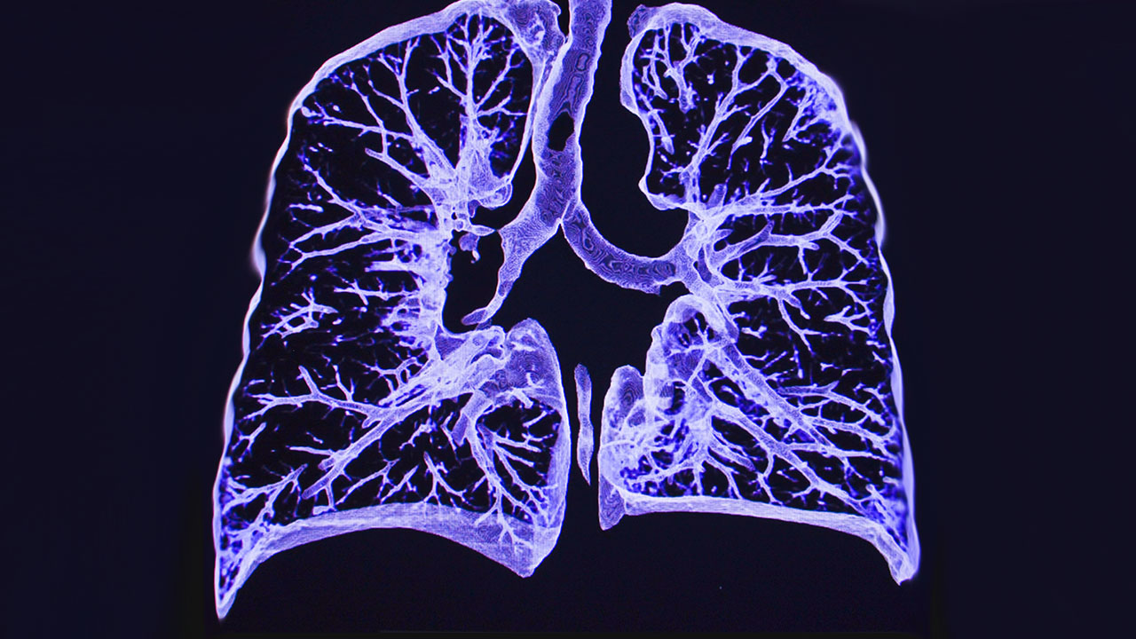 nm-leading-edge-tech-lung_feature