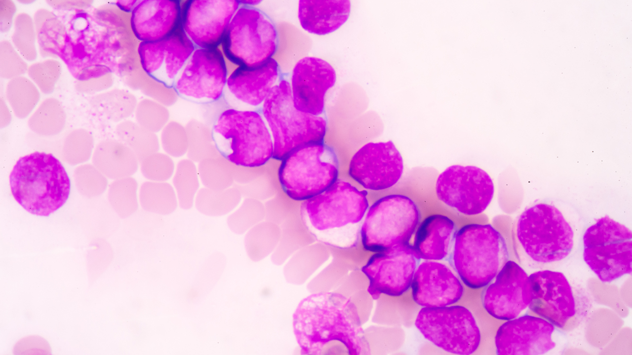 nm-stunting-the-spread-of-mll-feature