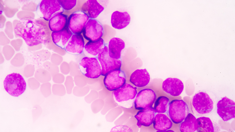 nm-stunting-the-spread-of-mll-preview