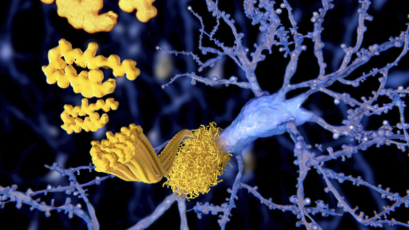 nm-what-we-know-about-alzheimers_preview