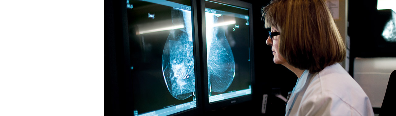Doctor examining a breast scan on the computer