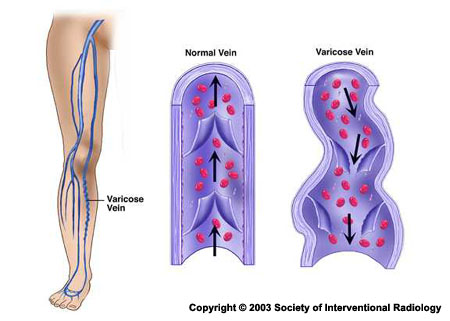 venous system