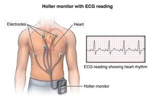 Holter monitor with ECG reading