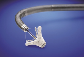 repair-mr-mitral-valve