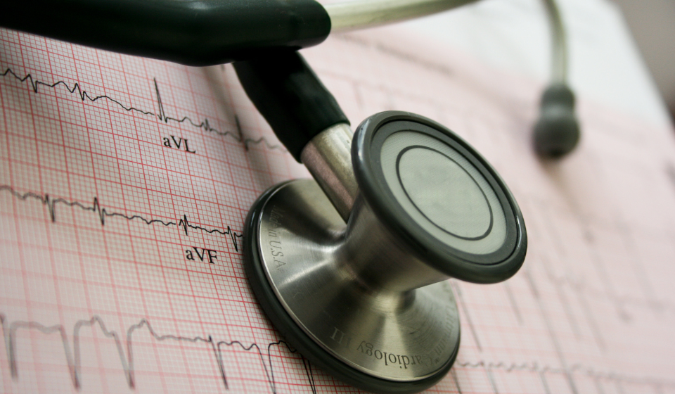 A stethoscope laying on top of a heart rhythm on a piece of paper.