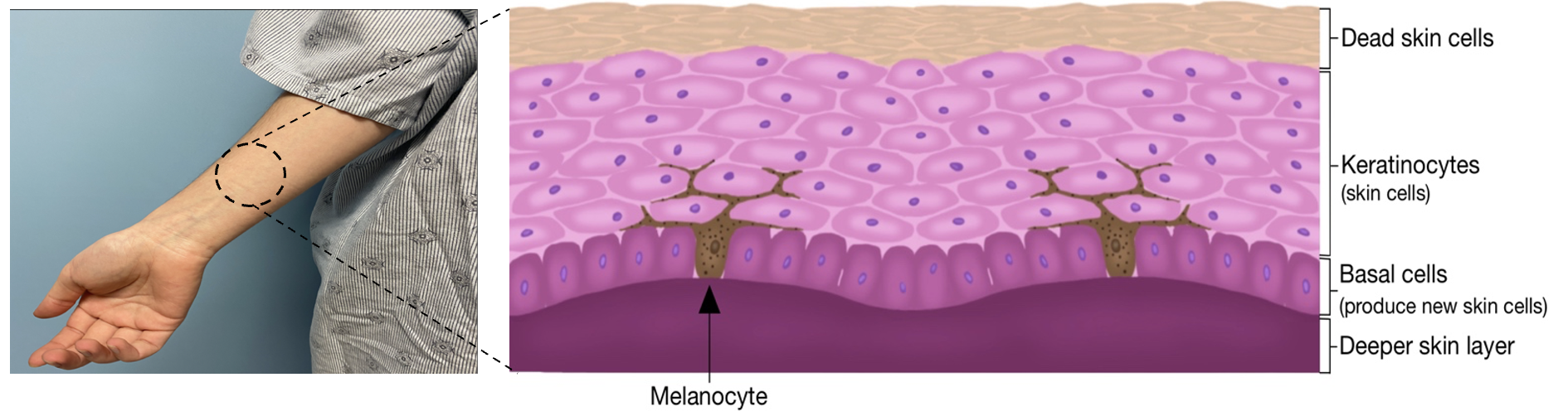 What normal skin looks like