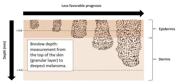 Treatment Northwestern Medicine
