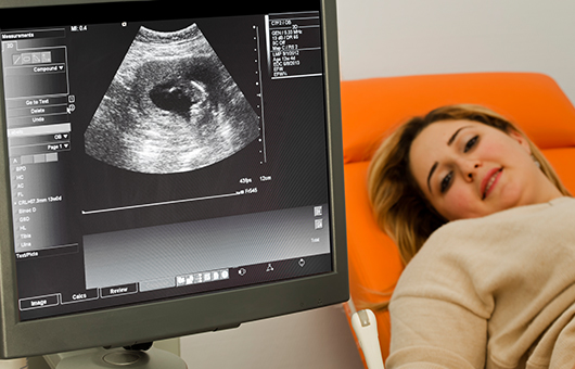 Northwestern Medicine mother during ultrasound smiling